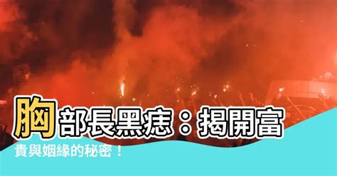 胸部長黑痣|別把癌當痣！5部位冒黑點恐是惡性黑色素瘤 台大醫師。